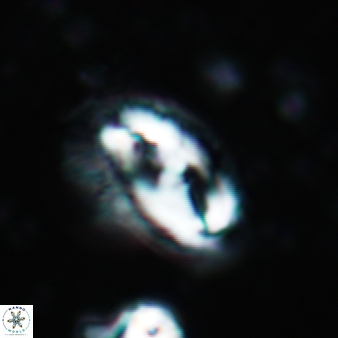 Helicosphaera waltrans 371