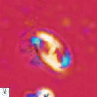 Helicosphaera waltrans 372