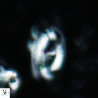 Helicosphaera waltrans 373