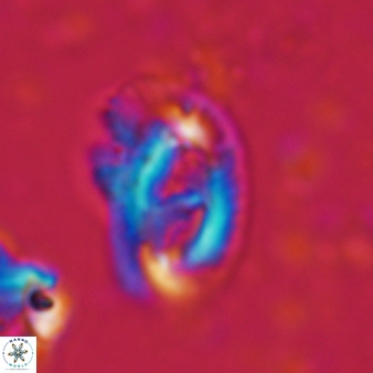Helicosphaera waltrans 374
