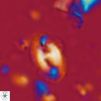 Helicosphaera waltrans 376
