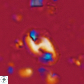 Helicosphaera waltrans 377