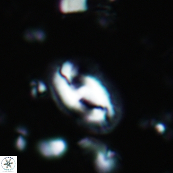 Helicosphaera waltrans 378