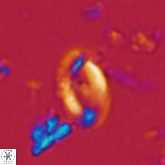 Helicosphaera waltrans 386