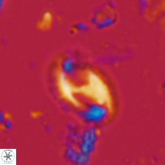 Helicosphaera waltrans 387