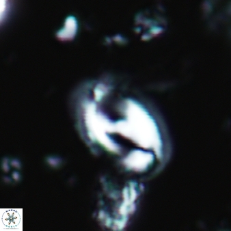 Helicosphaera waltrans 388