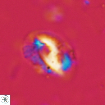 Helicosphaera waltrans 407