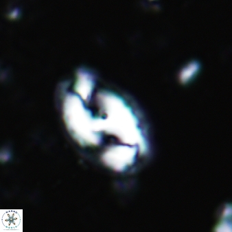Helicosphaera waltrans 409