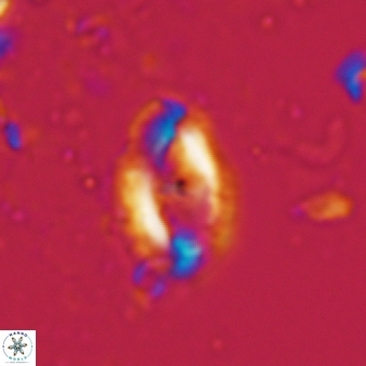 Helicosphaera waltrans 411