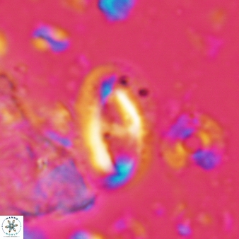 Helicosphaera waltrans 418