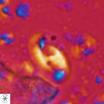 Helicosphaera waltrans 419