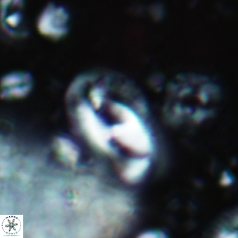 Helicosphaera waltrans 420