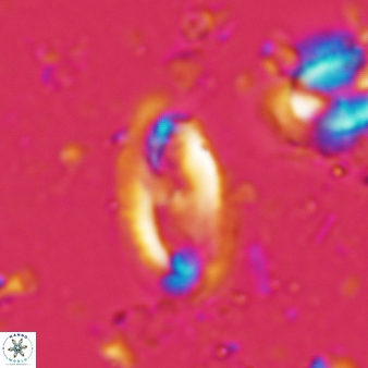 Helicosphaera waltrans 422