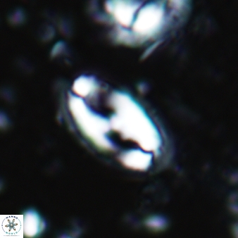 Helicosphaera waltrans 423