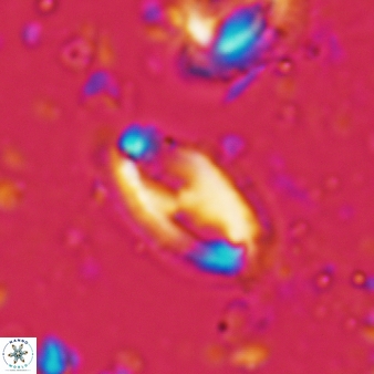 Helicosphaera waltrans 424