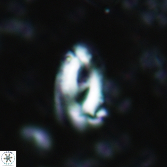 Helicosphaera waltrans 427