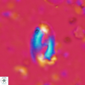 Helicosphaera waltrans 428