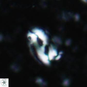 Helicosphaera waltrans 431