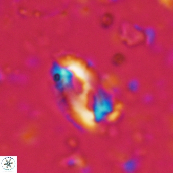 Helicosphaera waltrans 432