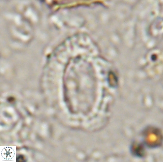 Helicosphaera watkinsii 14616