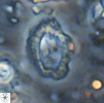 Helicosphaera watkinsii 14617