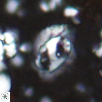 Helicosphaera watkinsii 14618