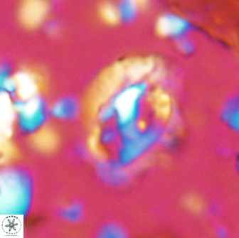 Helicosphaera watkinsii 14619