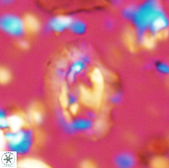 Helicosphaera watkinsii 14620