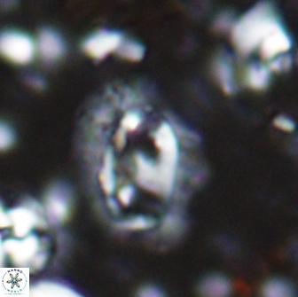 Helicosphaera watkinsii 14621