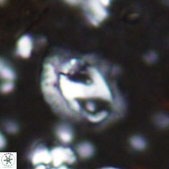 Helicosphaera watkinsii 14622