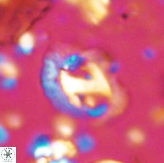 Helicosphaera watkinsii 14623
