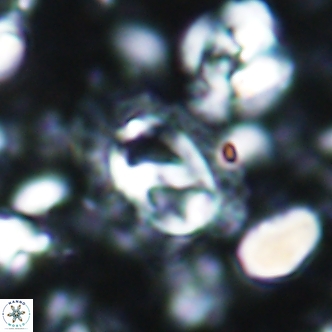 Helicosphaera watkinsii 1884