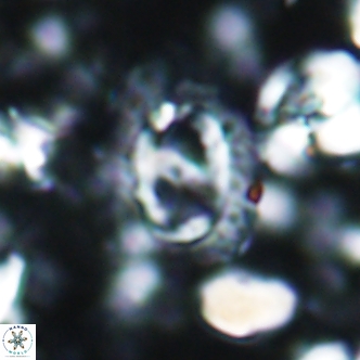 Helicosphaera watkinsii 1887