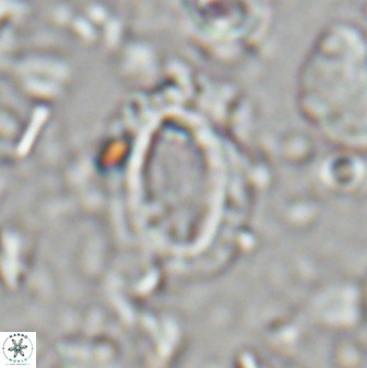 Helicosphaera watkinsii 27781