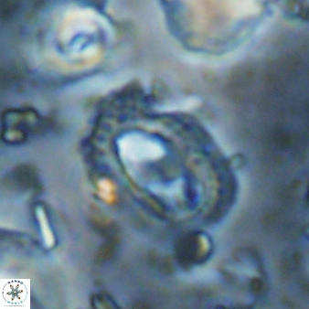 Helicosphaera watkinsii 27787