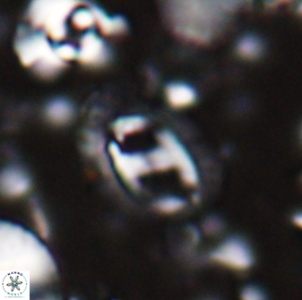 Helicosphaera watkinsii 27789