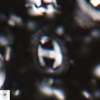 Helicosphaera watkinsii 27790
