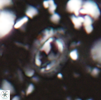 Helicosphaera watkinsii 27793