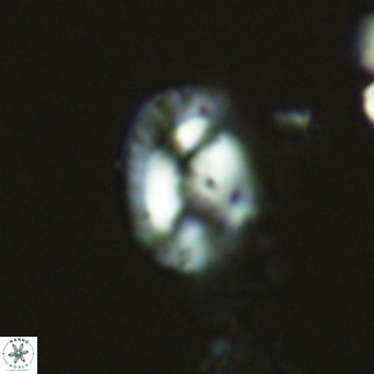 Helicosphaeranudus hyalina VR 04456