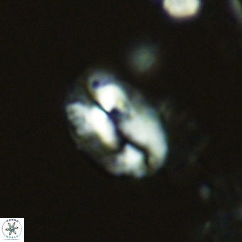Helicosphaeranudus hyalina VR 04460