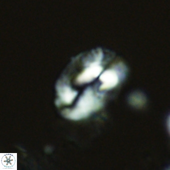 Helicosphaeranudus hyalina VR 04461