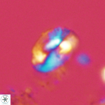 Helicosphaeranudus hyalina VR 04462