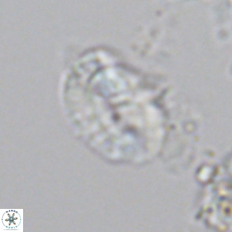Helicosphaeranudus hyalina VR 04464