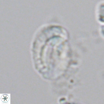 Helicosphaeranudus hyalina VR 04465