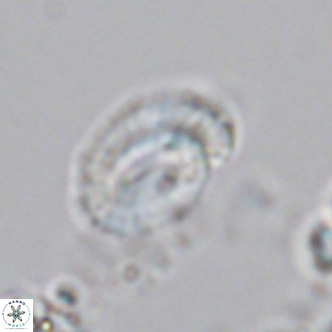 Helicosphaeranudus hyalina VR 04466