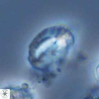 Helicosphaeranudus hyalina VR 04467