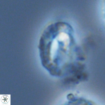 Helicosphaeranudus hyalina VR 04468