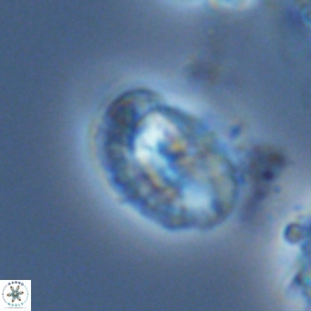 Helicosphaeranudus hyalina VR 04469
