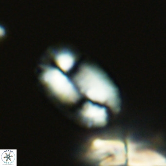 Helicosphaeranudus hyalina VR 09355