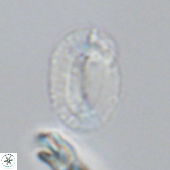 Helicosphaeranudus hyalina VR 09360
